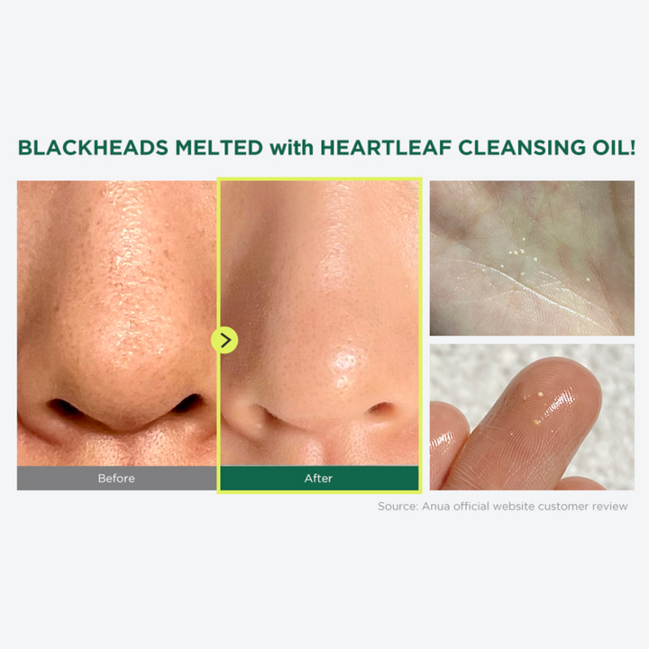 ANUA Heartleaf Pore Control Reinigungsöl (200ml) 
